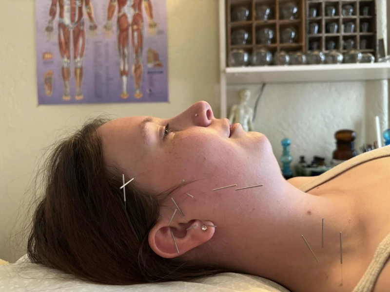 John Ditmars, LAc. – Integrative Acupuncture photo 5