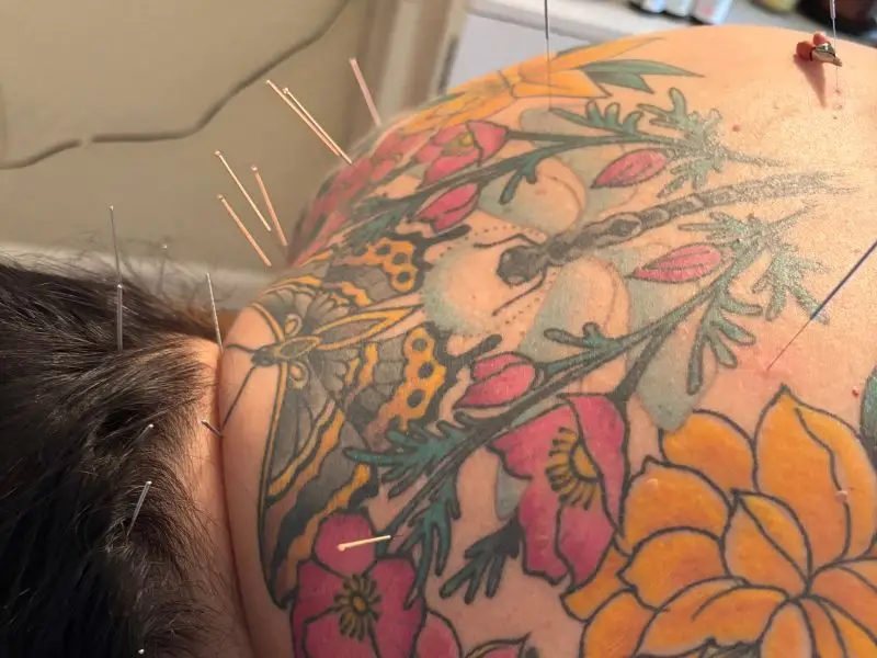 John Ditmars, LAc. – Integrative Acupuncture photo 7