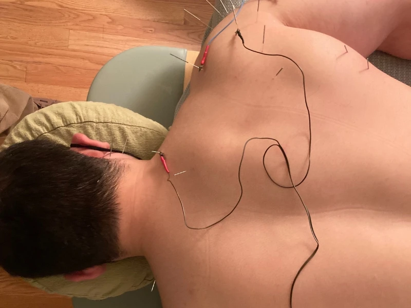 John Ditmars, LAc. – Integrative Acupuncture photo 6