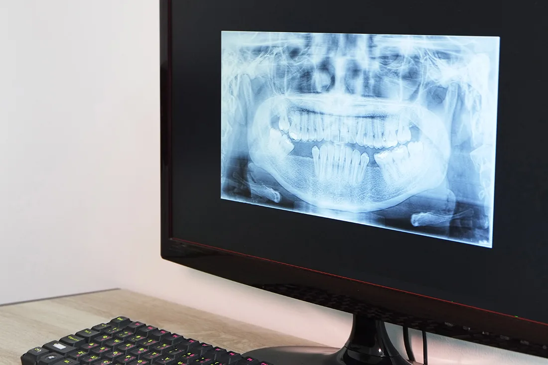 Sheldon Park Dental photo 10